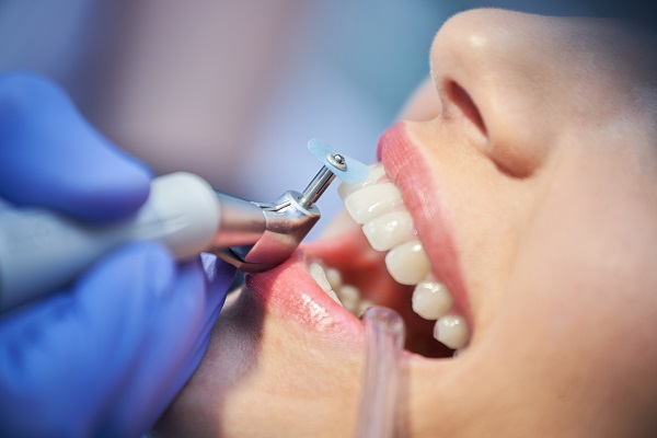 Gum Therapy &#    ; What Happens In A Deep Teeth Cleaning?